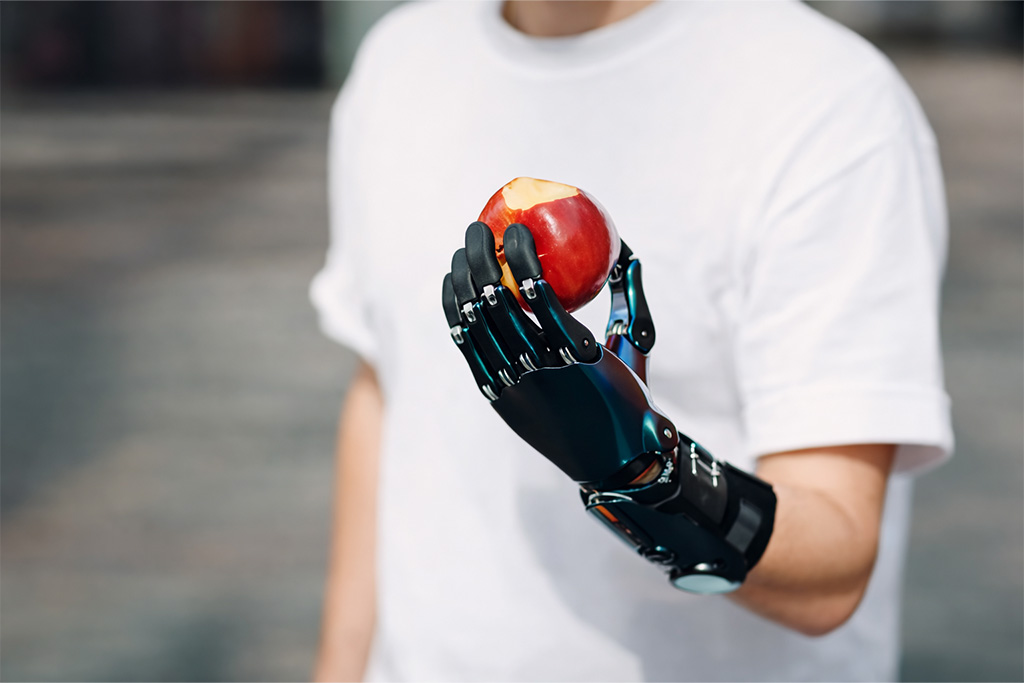 Trans-Radial Myoelectric Prosthesis (Below Elbow)-details